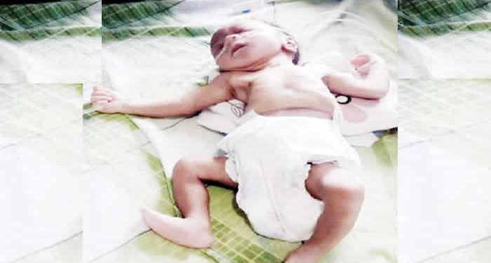 A day old baby abandoned in polythene bag rescued in Lagos