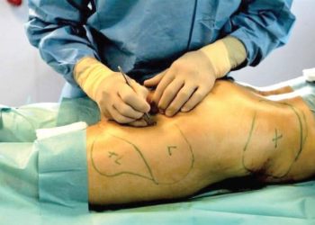 Lagos Police declares Doctor wanted After Woman Dies During Buttocks Enlargement surgery