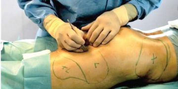 Lagos Police declares Doctor wanted After Woman Dies During Buttocks Enlargement surgery