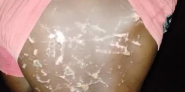 Benue: 14-Year-Old Boy Tortured Over Missing N200,000 Church Funds; Real Thief Confesses Weeks Later