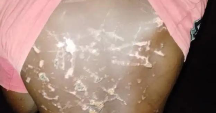 Benue: 14-Year-Old Boy Tortured Over Missing N200,000 Church Funds; Real Thief Confesses Weeks Later