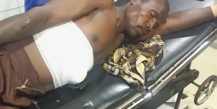 Abuja: Herbalist shoots himself While Testing Self-Made ‘Bulletproof’ Charm