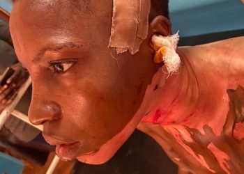 Man Arrested for Assaulting Wife with Hot Oil and Knife in Ogun State