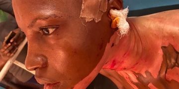 Man Arrested for Assaulting Wife with Hot Oil and Knife in Ogun State