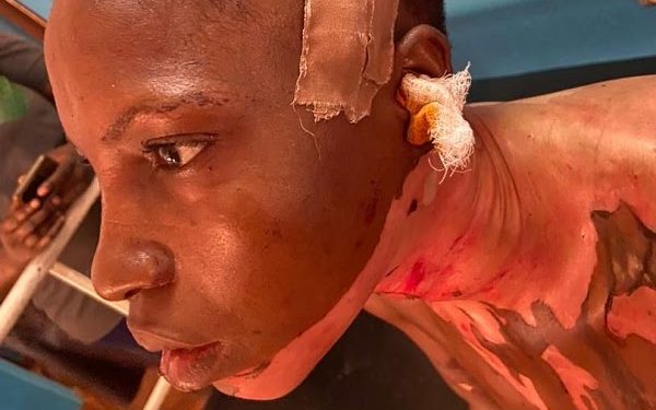 Man Arrested for Assaulting Wife with Hot Oil and Knife in Ogun State