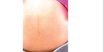 Parents tackle school over incisions on children’s bodies in Ogun