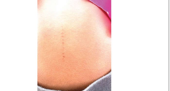 Parents tackle school over incisions on children’s bodies in Ogun