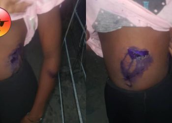 Lagos Mother Burns 7-Year-Old Daughter With Hot Iron Over Meat theft