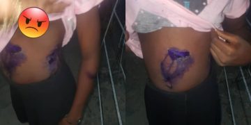 Lagos Mother Burns 7-Year-Old Daughter With Hot Iron Over Meat theft