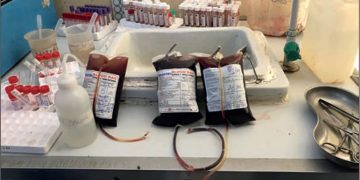 Jehovah’s Witness Cancer Patient Sparks Debate by Rejecting Blood Transfusion Despite ₦30m Donations