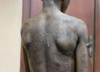 Lagos Mother Arrested Over Alleged Torture of 11-Year-Old Son