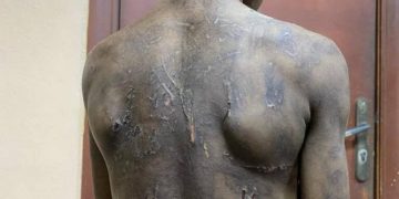 Lagos Mother Arrested Over Alleged Torture of 11-Year-Old Son