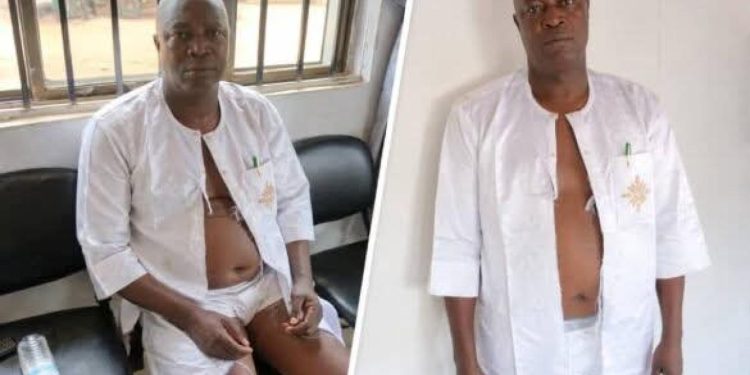 Suspected Thugs Assault, Strip Ondo Council Chairman