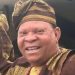 Adewale Elesho Undergoes Facial Surgery as ANTP Addresses Cancer Rumours