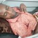 Taraba Man Dies After Wife Allegedly Cuts Off His Genitals Following Domestic Dispute