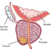 Prostate Cancer: Experts Urge Nigerian Men to Screen Early